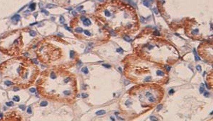 VEGF Rabbit Polyclonal Antibody