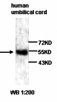 VEGF Rabbit Polyclonal Antibody