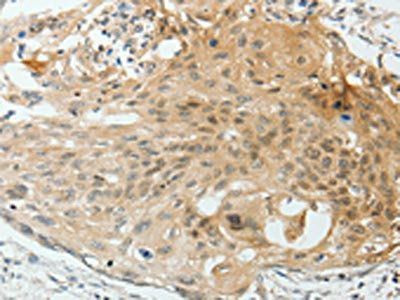 VEGFA Antibody