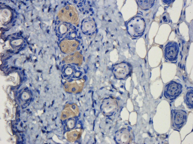 VEGF Rabbit Polyclonal Antibody