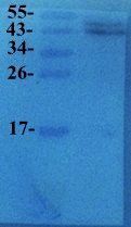 VEGF antibody