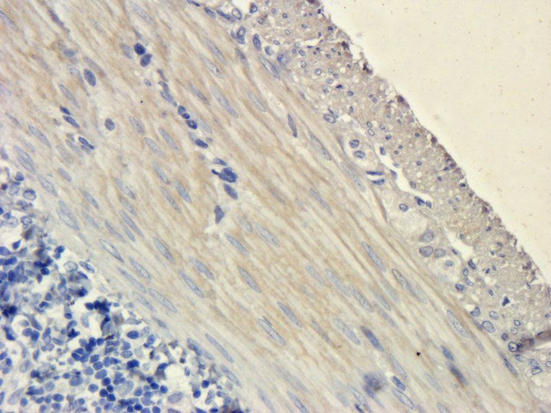 VEGF Mouse Monoclonal Antibody