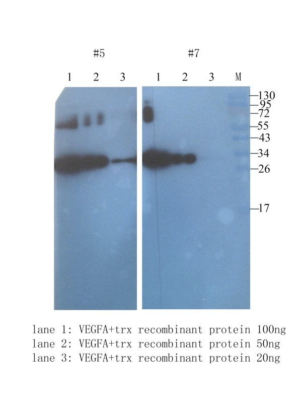 VEGF antibody