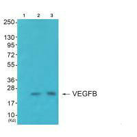 VEGFB antibody