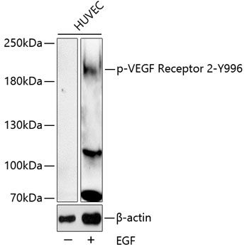 VEGFR2 (Phospho-Y996) antibody