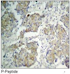 VEGFR2 (Phospho-Tyr1214) Antibody