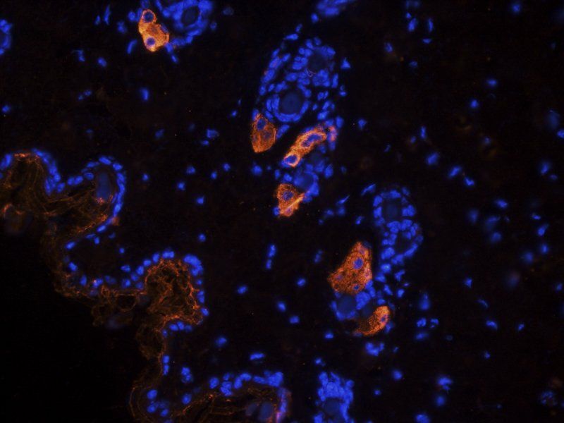 VEGFR3 Rabbit Polyclonal Antibody