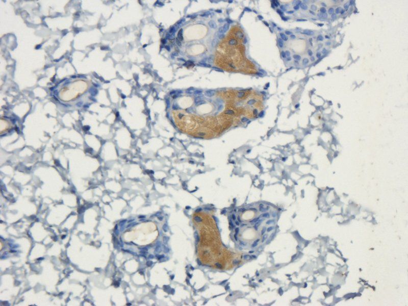 VEGFR3 antibody