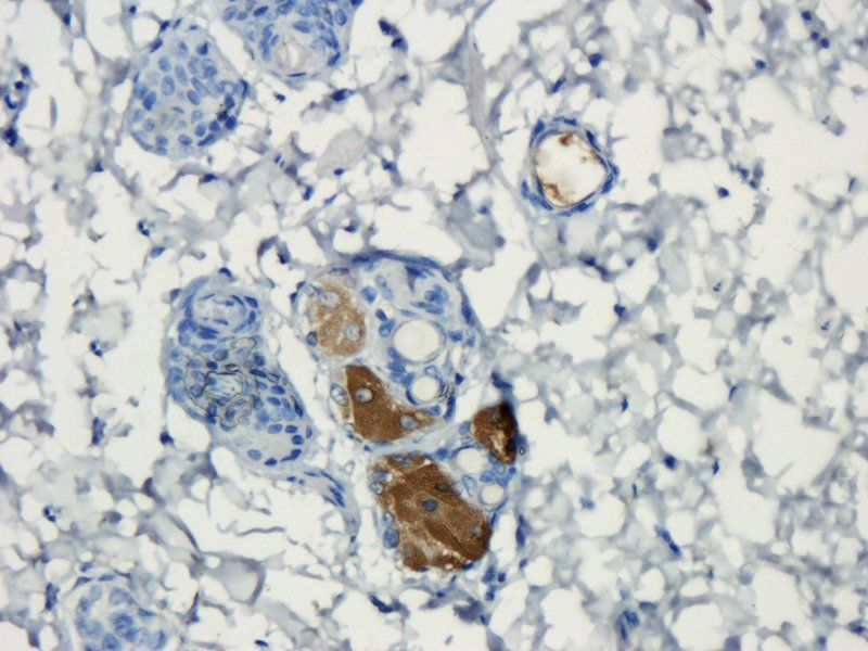 VEGFR3 Rabbit Polyclonal Antibody