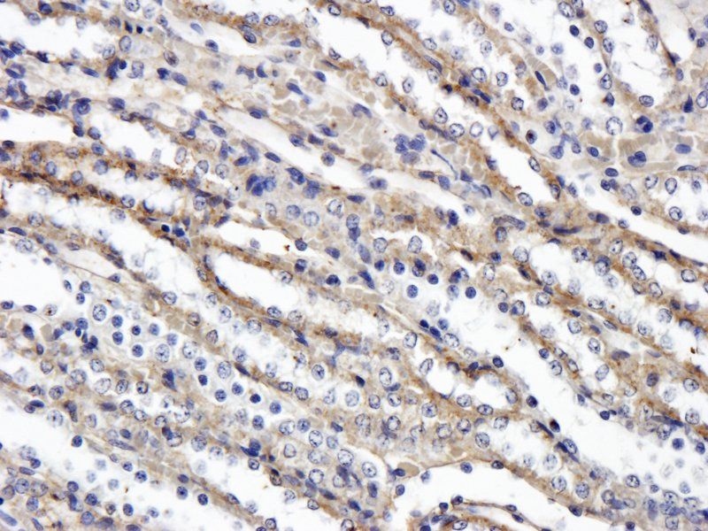 VEGFR3 antibody
