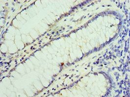 VENTX Antibody