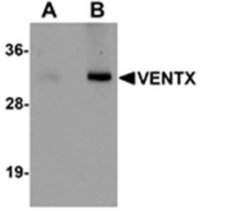 VENTX Antibody