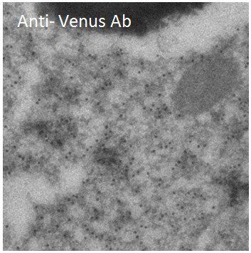 Venus antibody