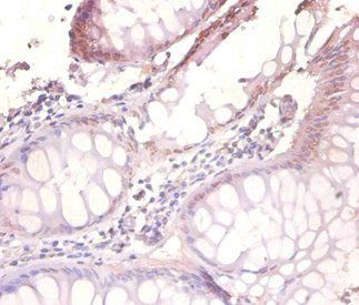 VAMP7 Antibody