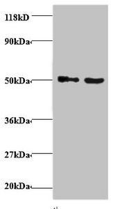 Vesicular, overexpressed in cancer, prosurvival protein 1 antibody
