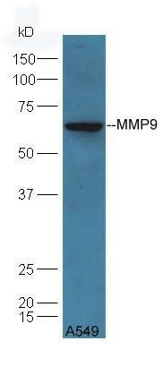VG5Q Rabbit Polyclonal Antibody