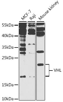 VHL antibody