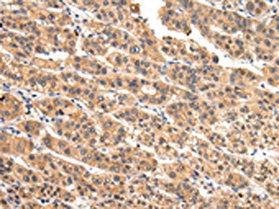 VIL1 Antibody