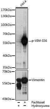 VIM (Phospho-S56) antibody