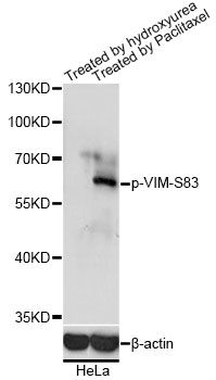 VIM (Phospho-S83) antibody