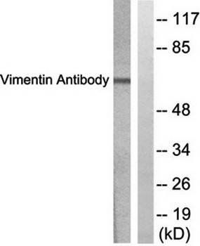 Vimentin antibody