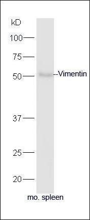 Vimentin antibody