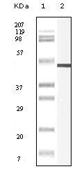 Vimentin Antibody