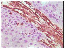 Vimentin Antibody