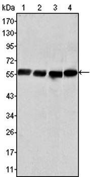 Vimentin Antibody