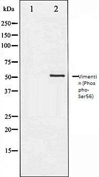 Vimentin (Phospho-Ser56) antibody