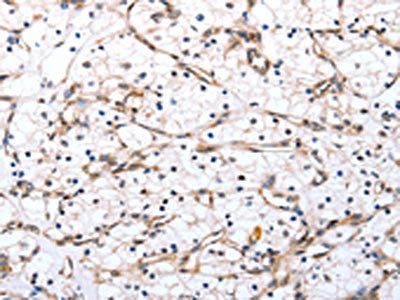 VIMP Antibody