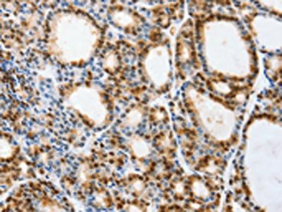 VIMP antibody