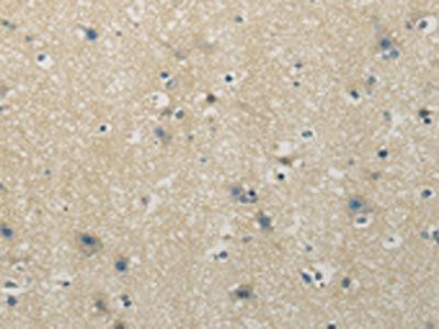 VIPR1 Antibody