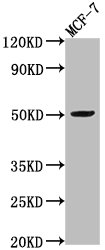 VIPR2 antibody