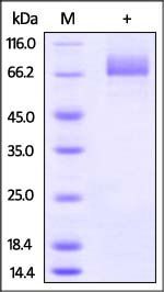 Influenza A (H5N1) Hemagglutinin (HA) Protein