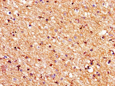 PROS1 Antibody