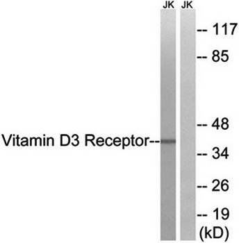 Vitamin D3 Receptor antibody