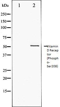 Vitamin D3 Receptor (Phospho-Ser208) antibody