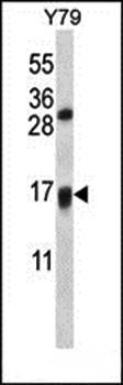 VKORC1L1 antibody