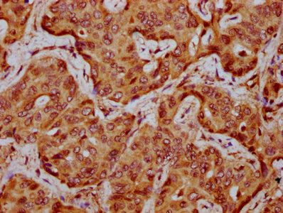 VLDLR Antibody