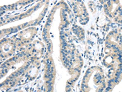 VLDLR Antibody