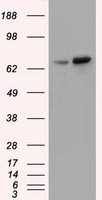 VMAT2 (SLC18A2) antibody