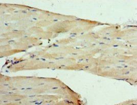 Voltage-dependent calcium channel subunit alpha-2/delta-1 antibody