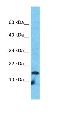 VPREB3 antibody