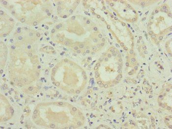 VPS11 Antibody