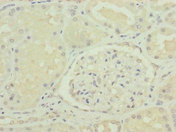 VPS11 Antibody