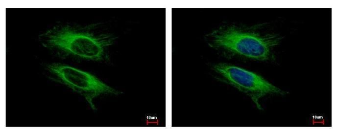 VPS11 antibody