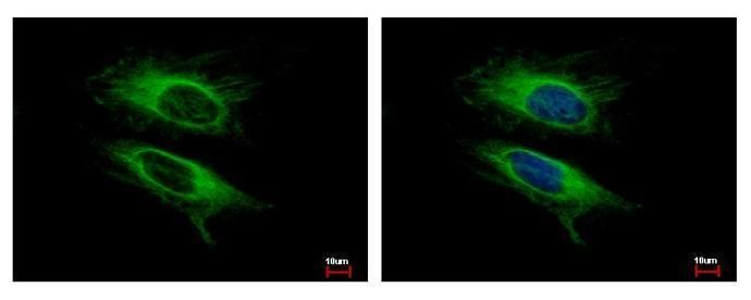 VPS11 core subunit of CORVET and HOPS complexes Antibody