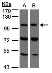 VPS11 Rabbit Polyclonal Antibody