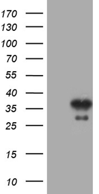 VPS13B antibody
